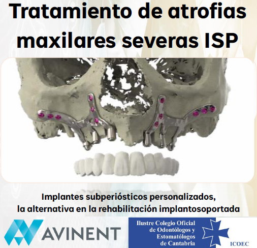 Conferencia Tratamiento de atrofias maxilares severas ISP