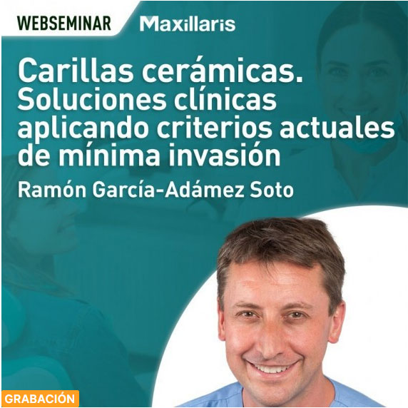 Webinar Gratuito. Carillas cermicas. Soluciones clnicas aplicando criterios actuales de mnima invasin