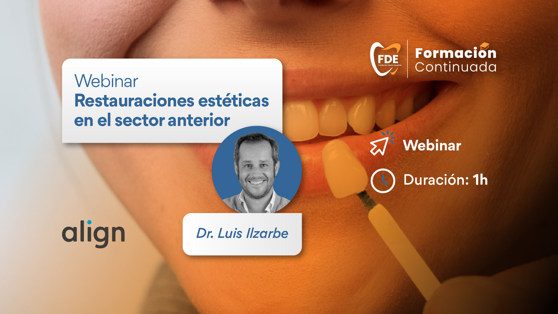 Webinar Gratuito Consejo General. "Restauraciones Est�ticas en el Sector Anterior."